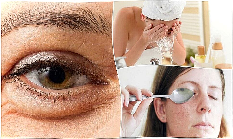 6 natural methods to reduce bags under the eyes