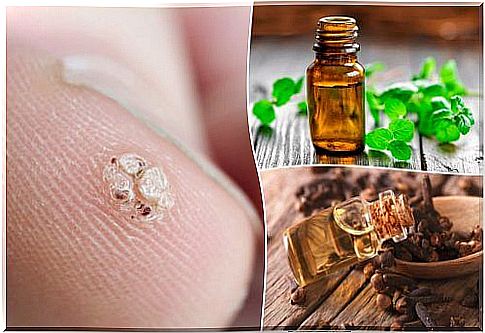 7 essential oils to help you get rid of warts