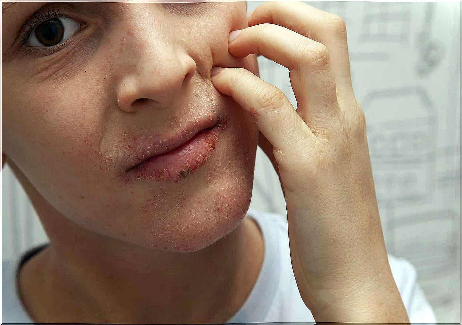 A boy scratching his face