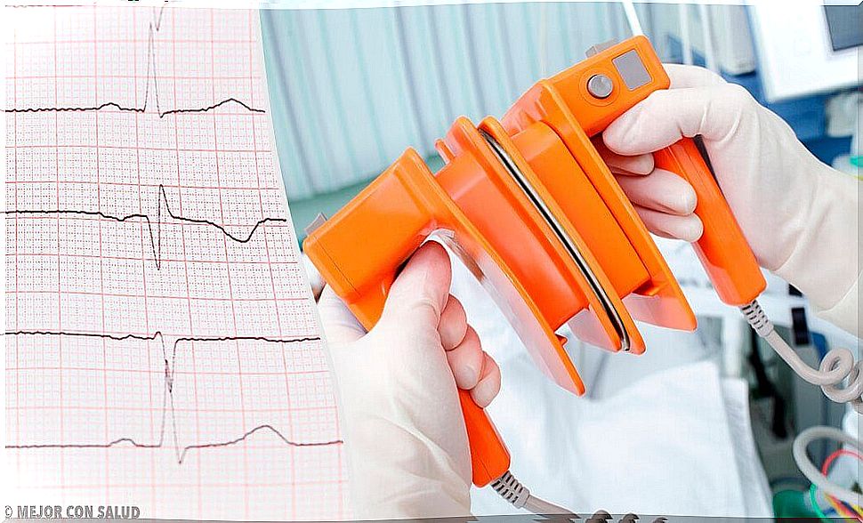 arterial fibrillation and defibrillators