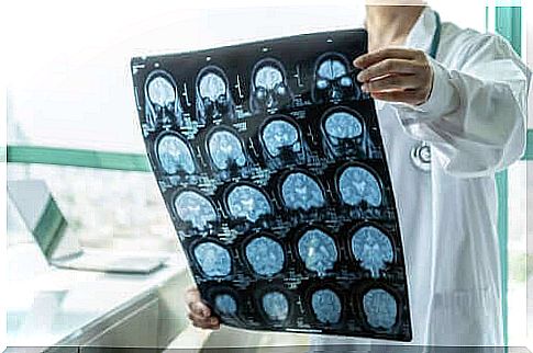 Doctor with scans of brain