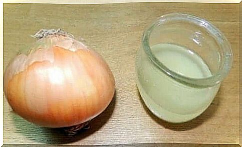 Onion juice helps prevent scarring and relieves pain caused by burning