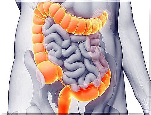 Picture of the intestine