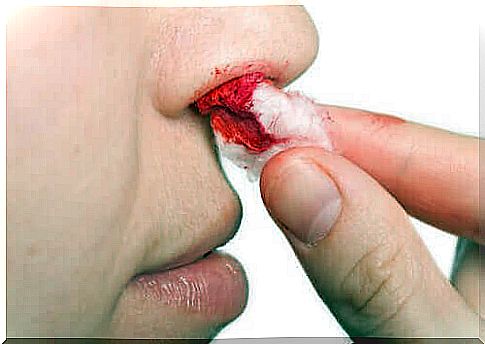 Nosebleeds can be a product of excessive dryness in the area