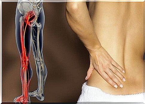 Person with sciatica pain