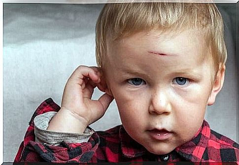 Boy with cuts on his forehead